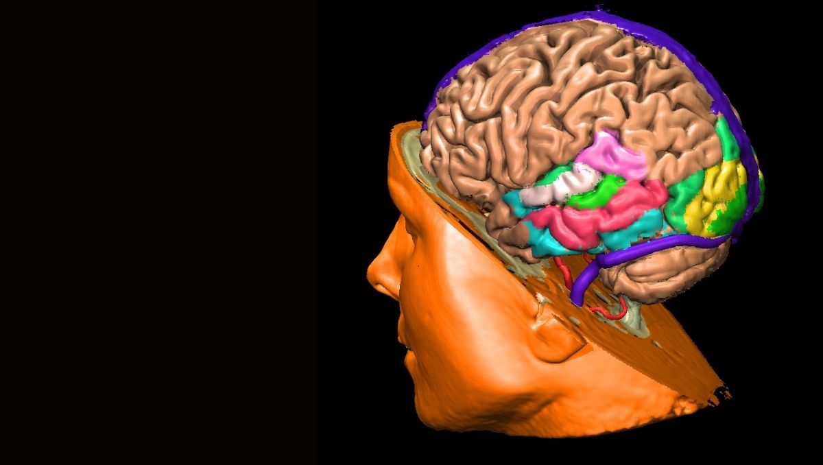 cirugia-epilepsia-teknon-barcelona