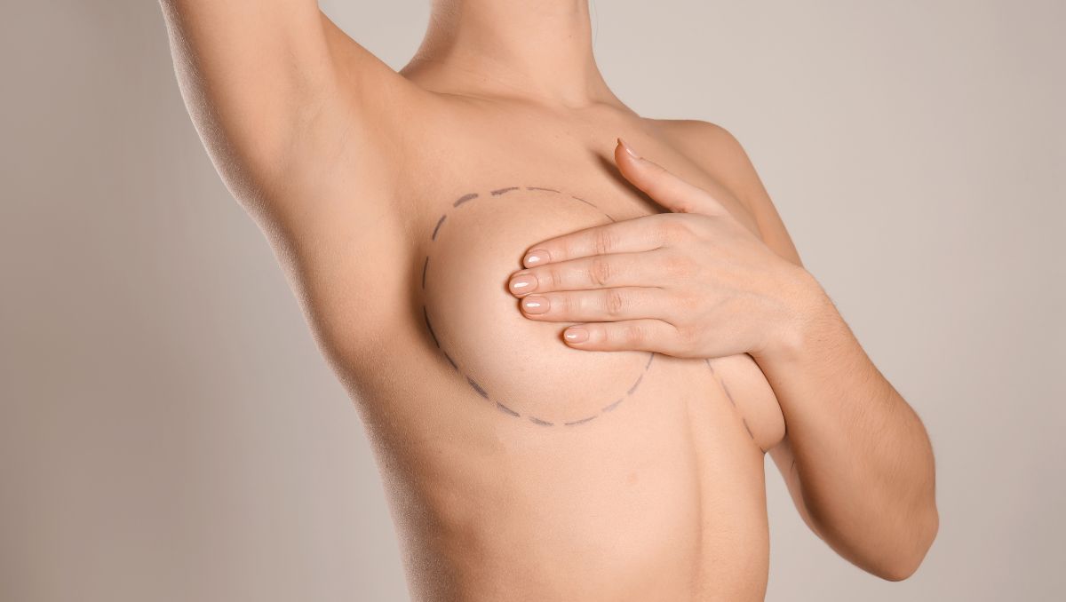 Intervención aumento de pecho