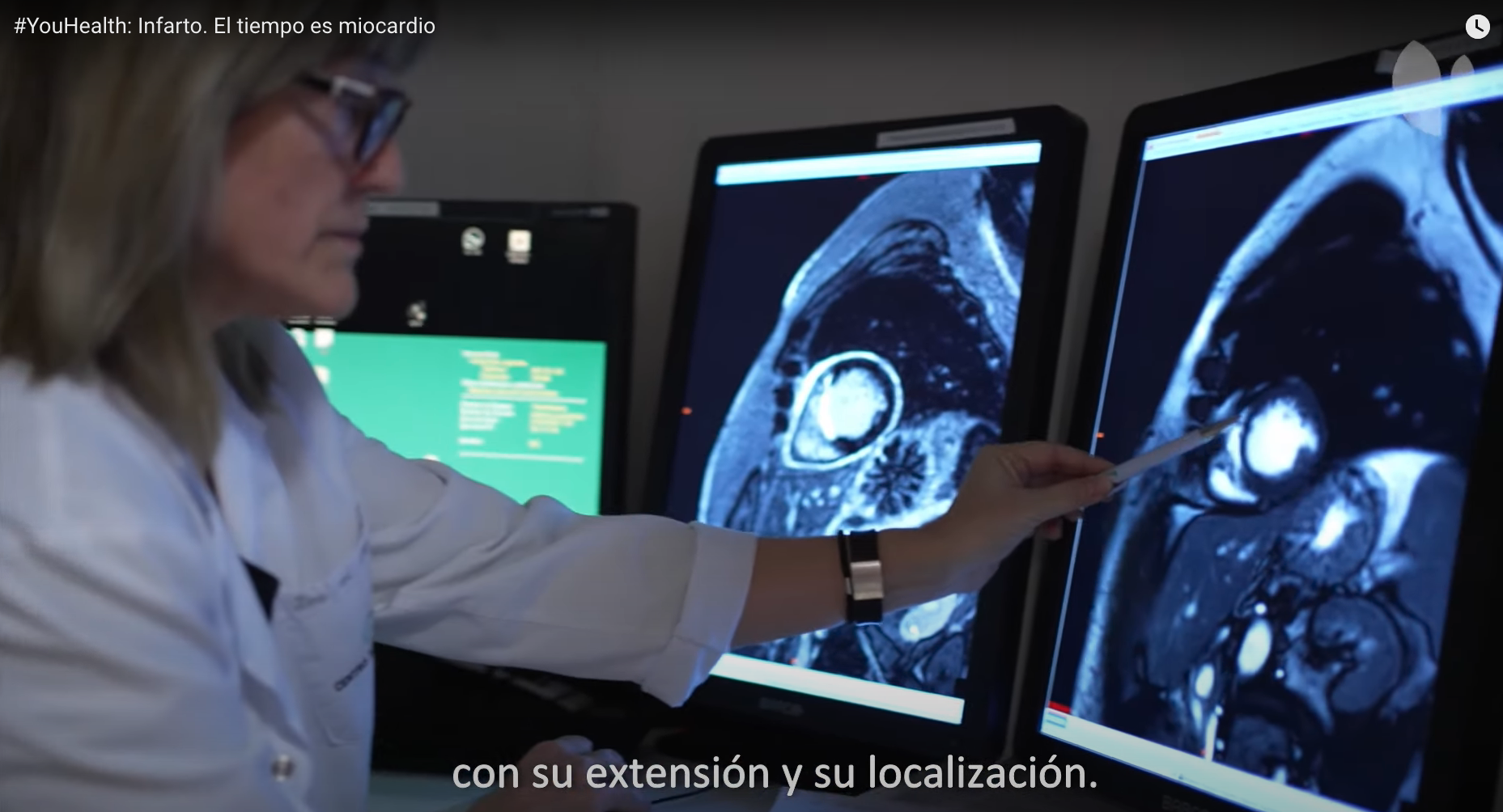 Diagnóstico infarto agudo de miocardio. Este enlace se abrirá en una ventana nueva