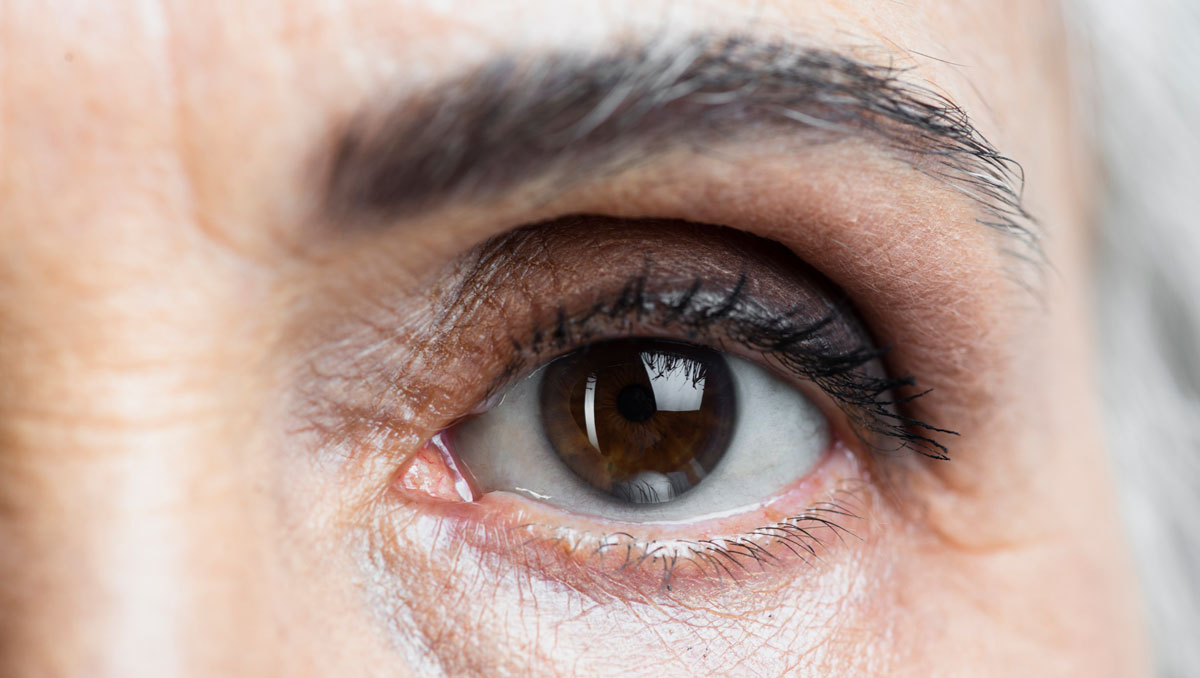 ptosis-barcelona-teknon