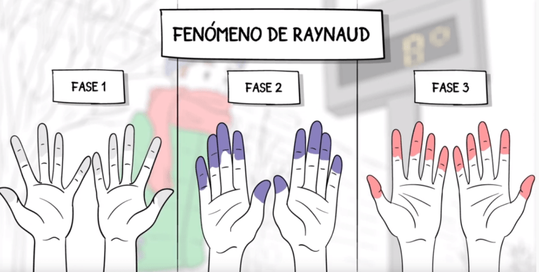RAYNAUD IMAGEN INFOREUMA