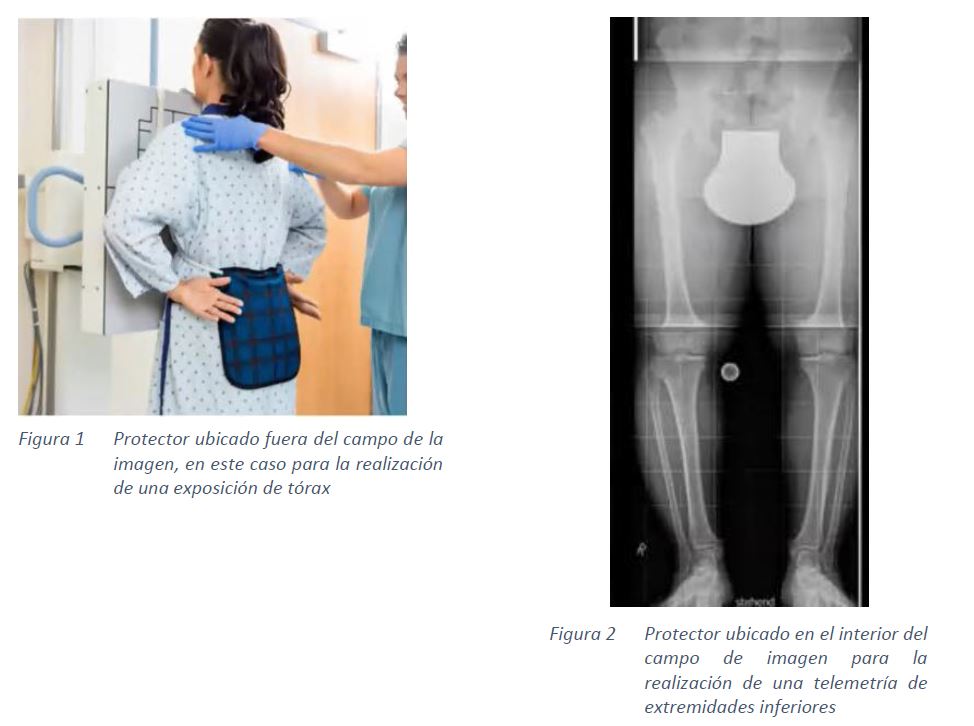 protección radiológica Teknon
