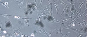 celulas mesenquimales