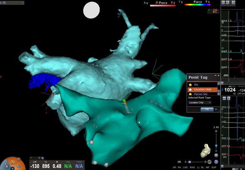 Electrofisiología y Arritmias