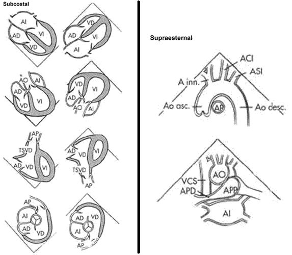 Ecocardiografía 3