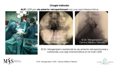 Diapositiva3
