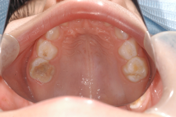 Odontopediatria 2