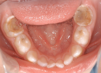 Odontopediatria 3
