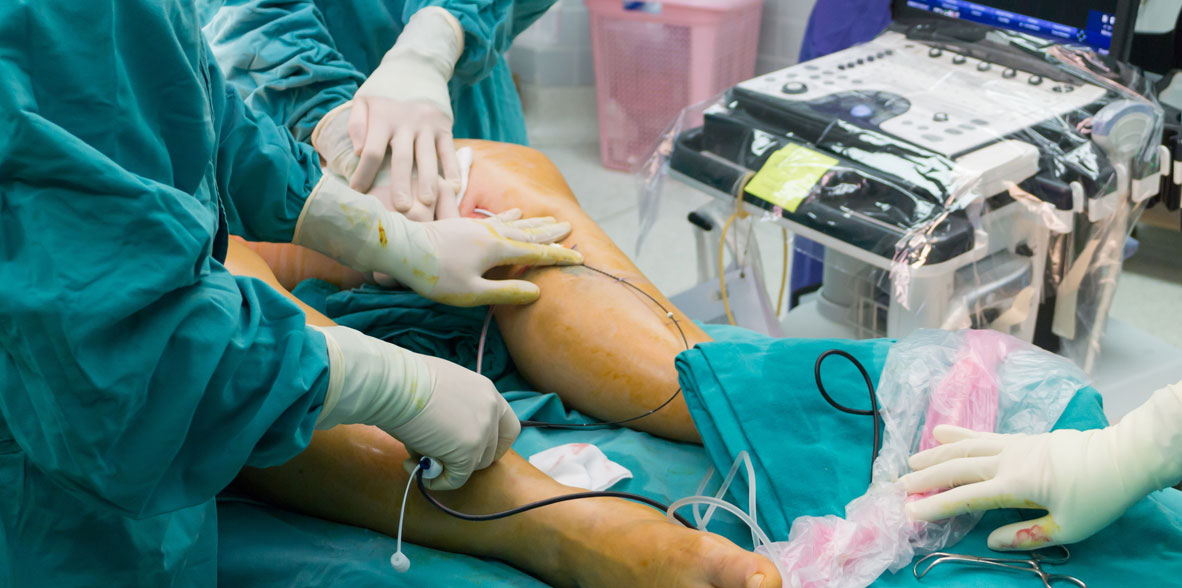 Angiología y Cirugía Vascular.jpg