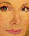 Aspecto postoperatorio de blefaroplastia