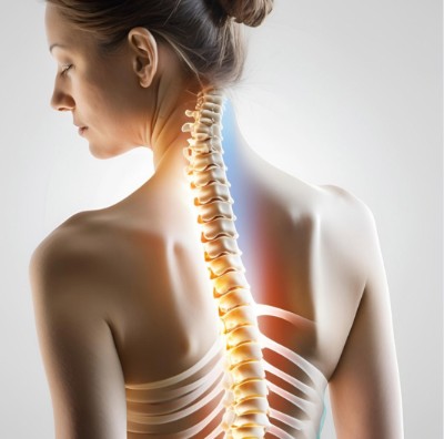 cirugia-escoliosis
