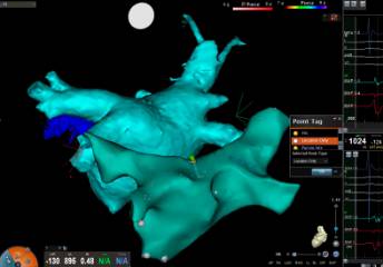 Electrofisiología-y-arritmias-cardíacas