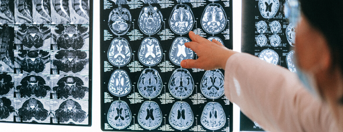 neurologia