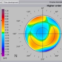 ABERROMETRIA-PRUEBA-OFTALMOLOGIA-OFTALNOVA-BARCELONA-3-200x200