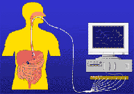 Manometría esofágica