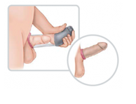 dispotivo de vacio pene