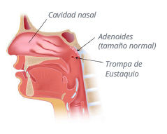 ilustracion_amigdalas_01