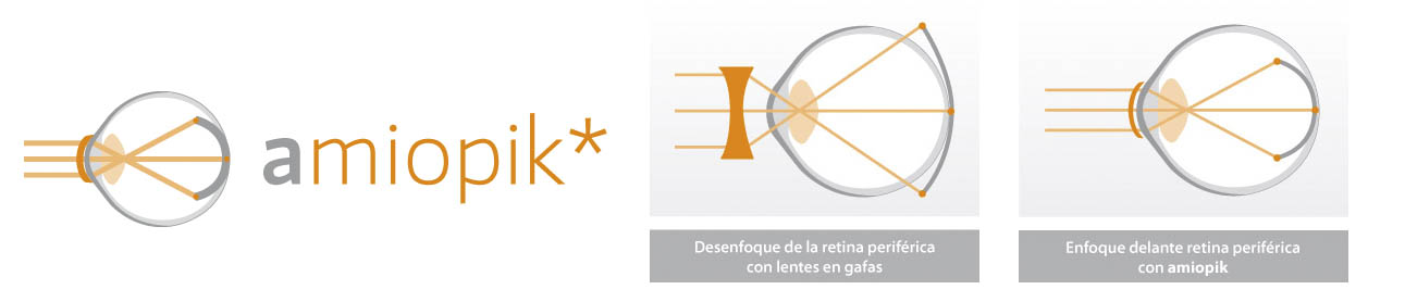 amiopik. Este enlace se abrirá en una ventana nueva