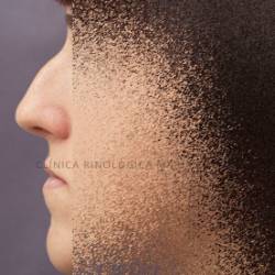 Resultats_perfil_pre