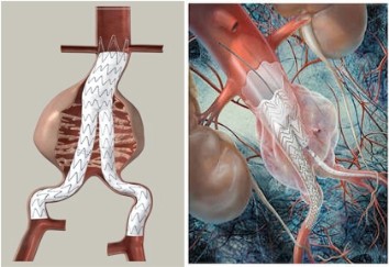 cirugia electiva