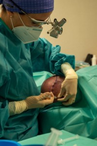 cirugia anesteisa capilar Teknon