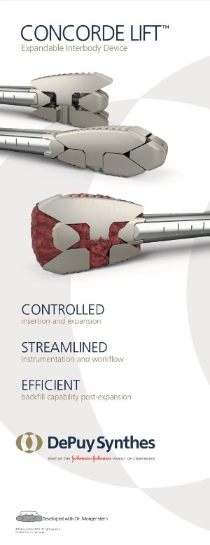 concorde lift expandable