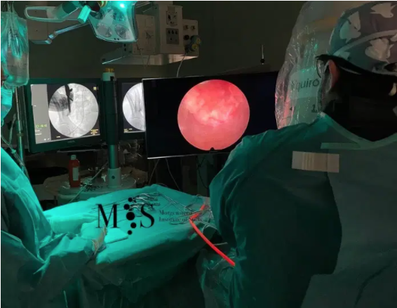 endoscopia de la articulacion sacroiliaca