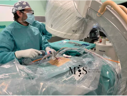 intra-operatoria endoscopia articulacion sacroiliaca