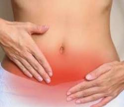 foto 3 -miomas dolor