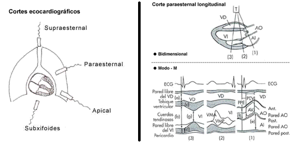 Ecocardiografía-1