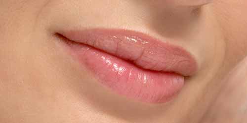 aumento-labios-acido-hialuronico-medicina-estetica-barcelona-teknon