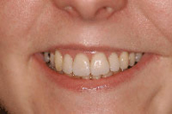 Después del proceso