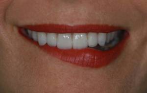 después labios rojos