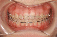 Después del proceso