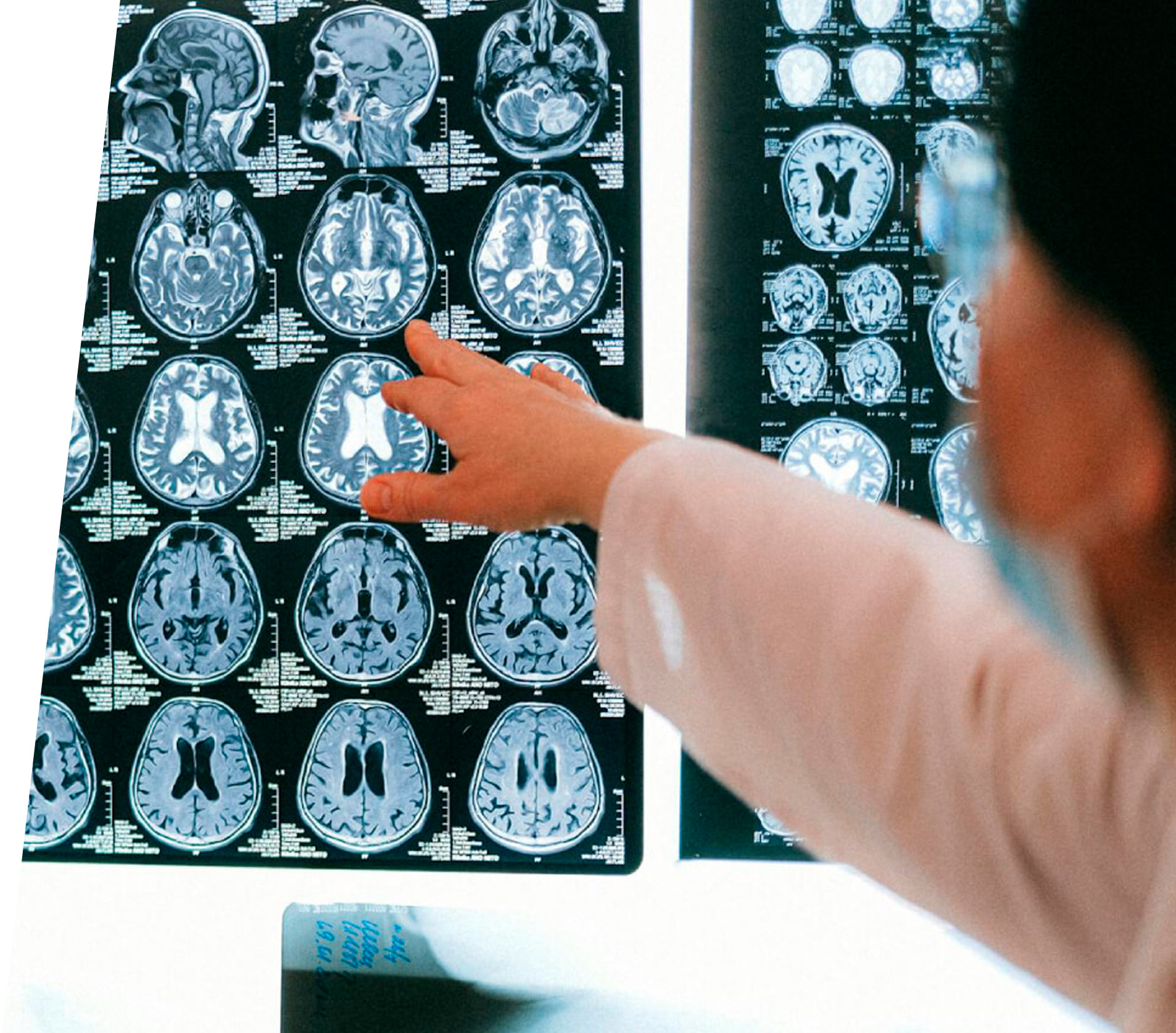 Neurología y Neurocirugía