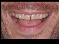 Diapositiva1