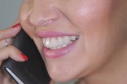 carillas de porcelana lateral después