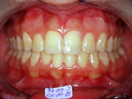 Después del proceso