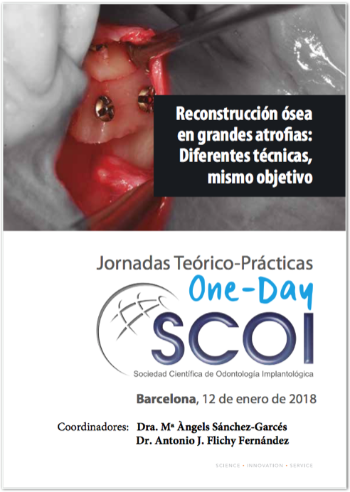 resconstruccion osea en grandes atrofias tecnicas y objetivo