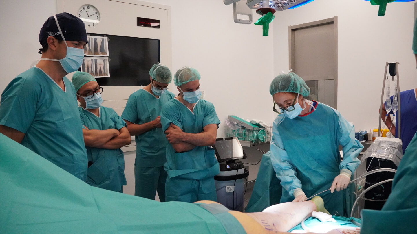 Curso hands on en cirugia lipedema