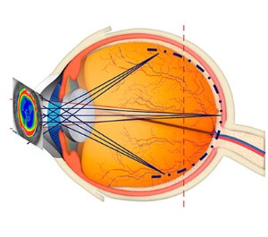 lentes_amiopik