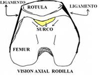 Rótula