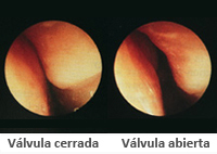 Válvula