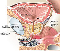 que es la prostata_2