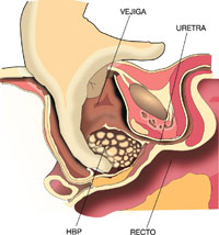 tecnicas quirurgicas_1