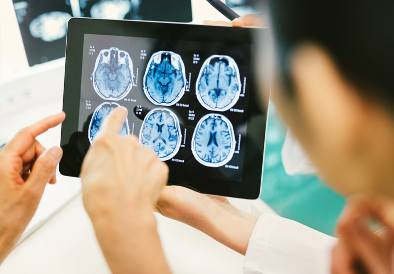 Patologías Neurovasculares