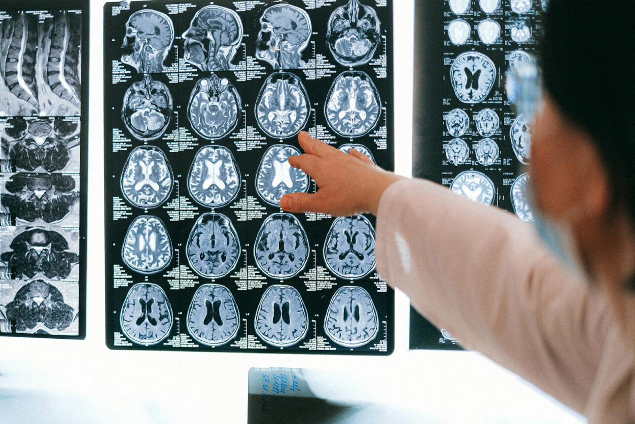Neurología y Neurocirugía móvil