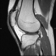 RM Rodilla