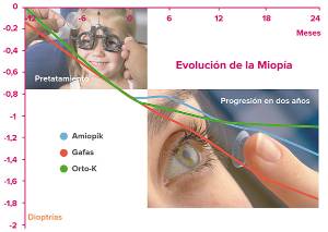 grafico lente de contacto Amiopik