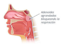 ilustracion_amigdalas_02